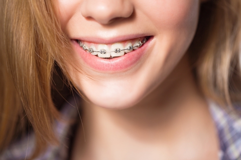 Braces | Dental | Retainers | Dentist | Pershing | Tri-City | Central City | Alda | NE